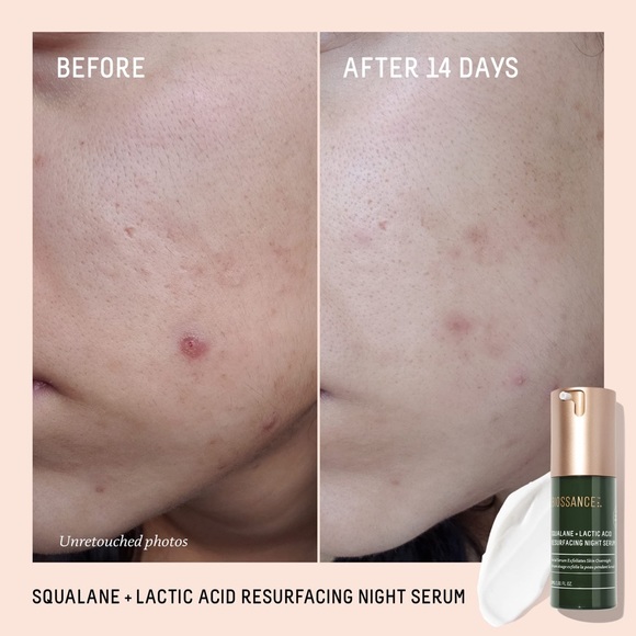 ✨🥇AWARD WINNING!🥇✨BIOSSANCE Squalane + Lactic Acid Resurfacing Night Serum - Picture 11 of 13